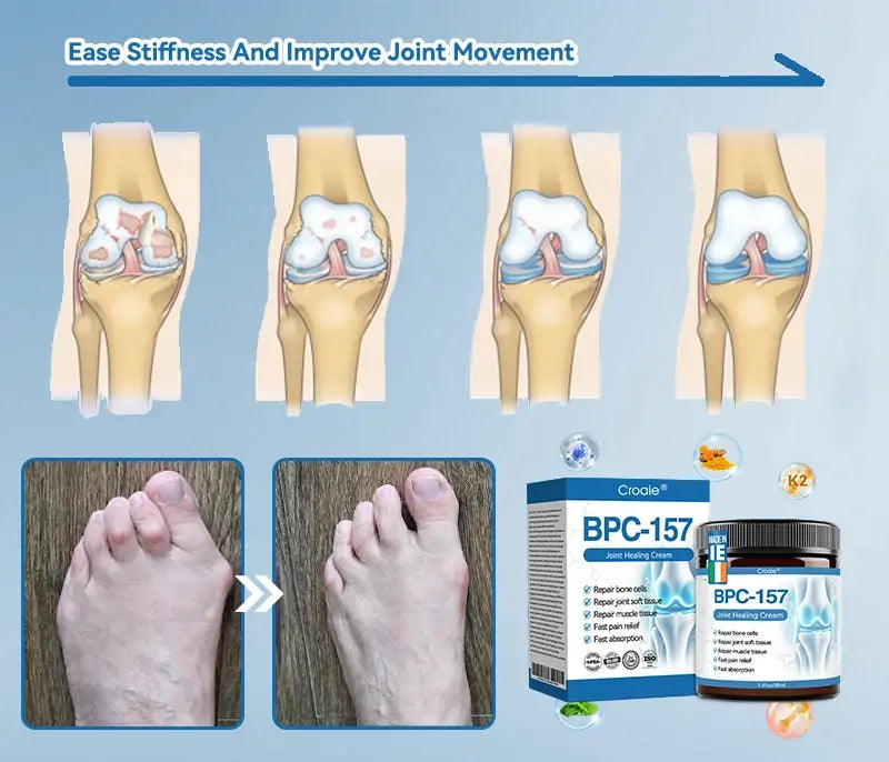 | 𝐋𝐚𝐬𝐭 𝐃𝐚𝐲 𝐏𝐫𝐨𝐦𝐨𝐭𝐢𝐨𝐧 𝟖𝟎% 𝐎𝐅𝐅 |  🇮🇪🦴𝐂𝐫𝐨𝐚𝐢𝐞® 𝐁𝐏𝐂-𝟏𝟓𝟕 𝐉𝐨𝐢𝐧𝐭 𝐇𝐞𝐚𝐥𝐢𝐧𝐠 𝐂𝐫𝐞𝐚𝐦 - 𝘛𝘳𝘦𝘢𝘵𝘴 𝘈𝘳𝘵𝘩𝘳𝘪𝘵𝘪𝘴, 𝘕𝘦𝘶𝘳𝘰𝘱𝘢𝘵𝘩𝘺, 𝘙𝘩𝘦𝘶𝘮𝘢𝘵𝘪𝘴𝘮, 𝘚𝘱𝘰𝘳𝘵𝘴 𝘐𝘯𝘫𝘶𝘳𝘪𝘦𝘴 & 𝘔𝘰𝘳𝘦🏆